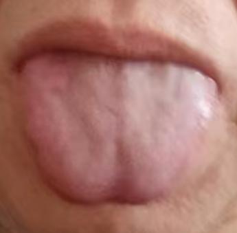 走出补阳误区：温阳祛湿，调理男性精气稳固心得








行事不力，宗筋敏感