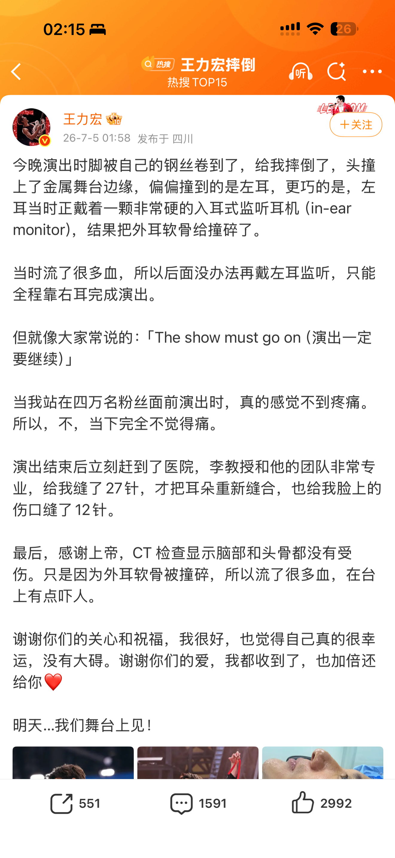 王力宏你会不会太敬业了点受伤这样明天依旧坚持✊🏻演出