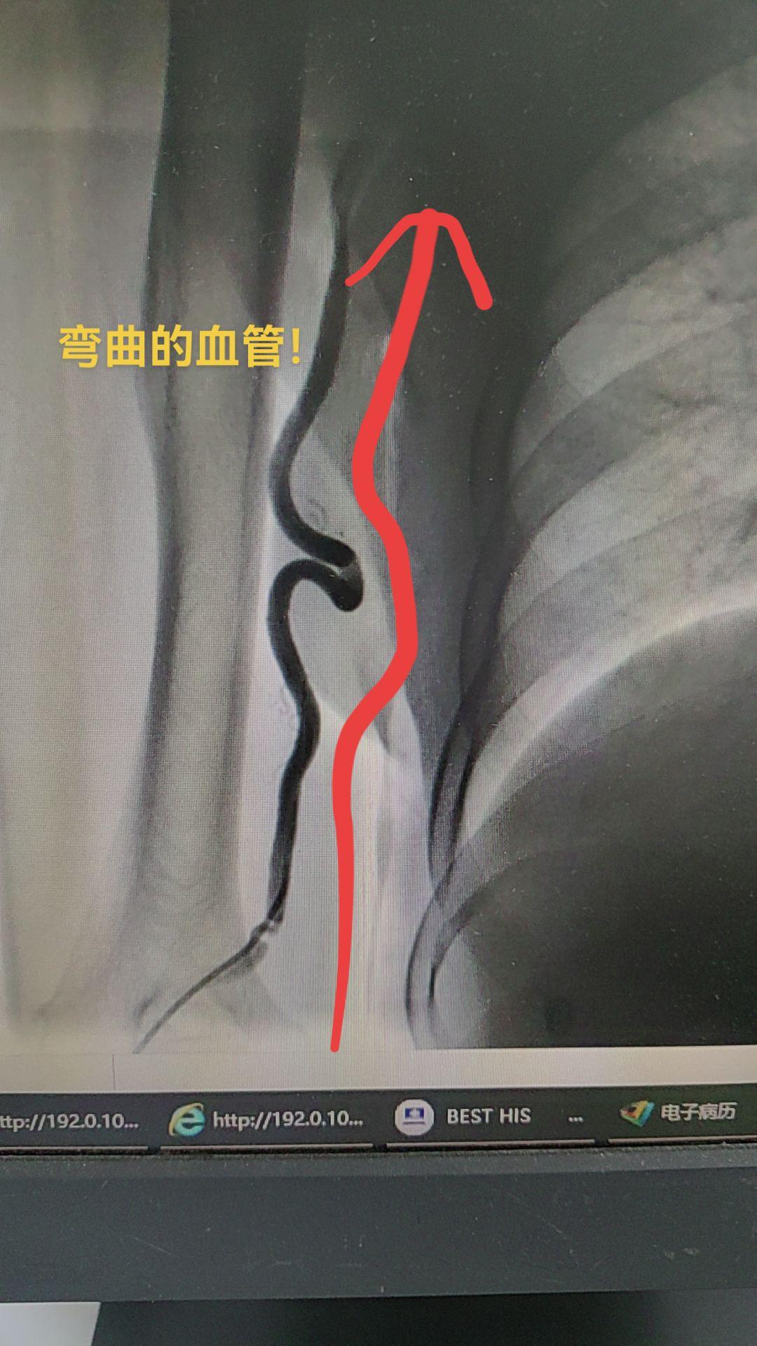 医生日常 医学科普仅供参考如有不适请线下就医 医学科普 医路前行 医学影像