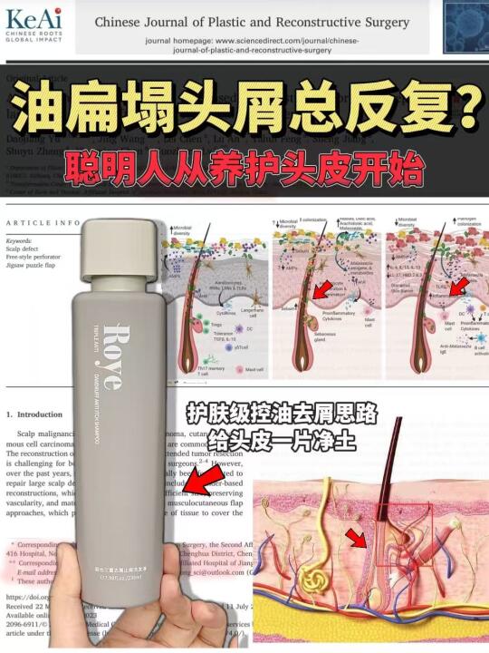 头油雪花细软塌？内行人不语只是一味回购