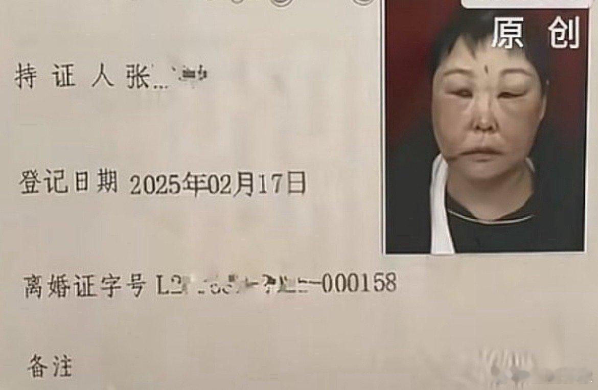 被前夫打进ICU女子不幸身亡最可怕的是这位女士连离婚证上的照片都那么惨不忍睹。遇