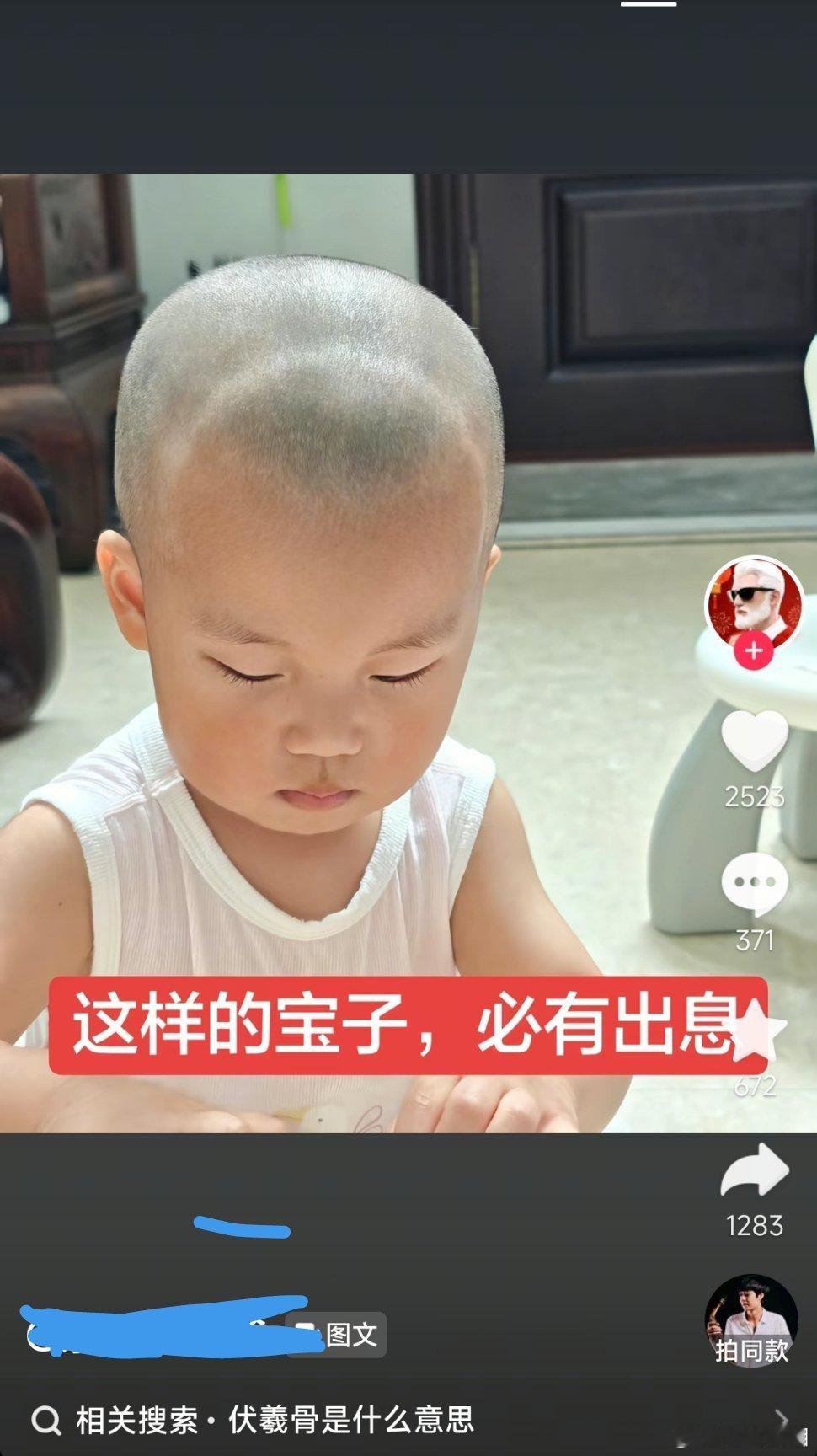 根据我的观察，小孩子似乎挺多头骨是这样的，和伏羲骨并没有关系，而是没有发育完全，