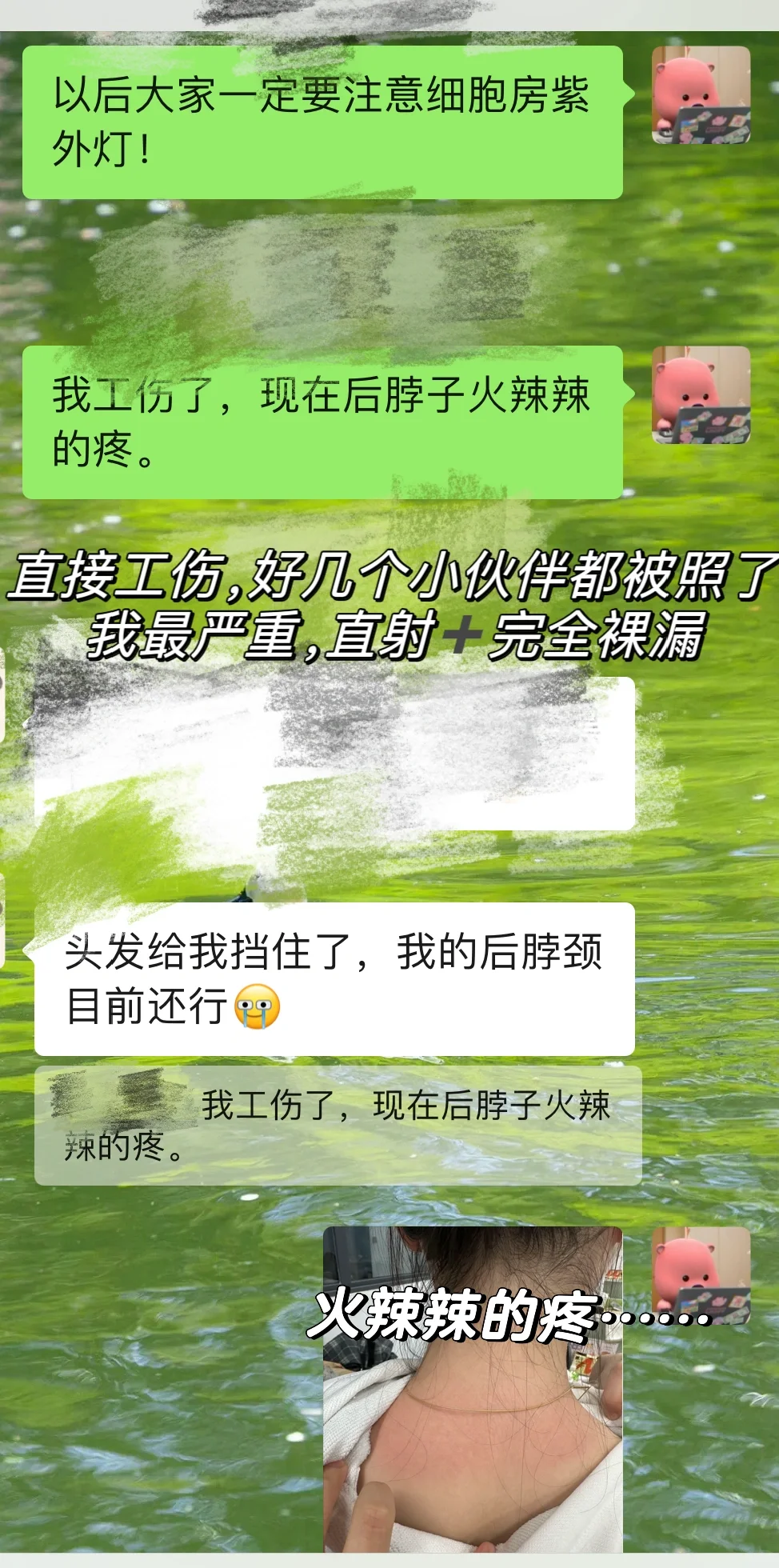 被细胞房紫外直射3个多小时，受了工伤‼️