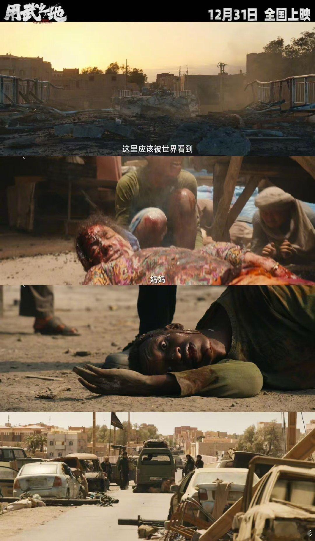 郑恺新片完全是生理性痛苦 郑恺演的苗峰被炸后倒地求救的样子，半条腿连皮带肉挂着，