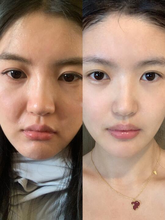 练背+欧莱雅小蜜罐面膜=妈生好皮回春术！