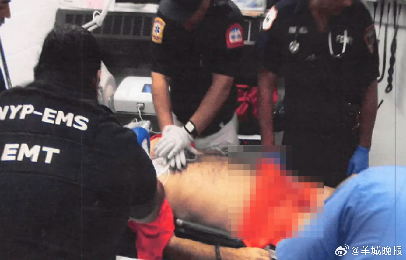 #爱泼斯坦自缢后照片首度公开#【爱泼斯坦“自缢”后照片首度公开：脖子有血色勒痕，