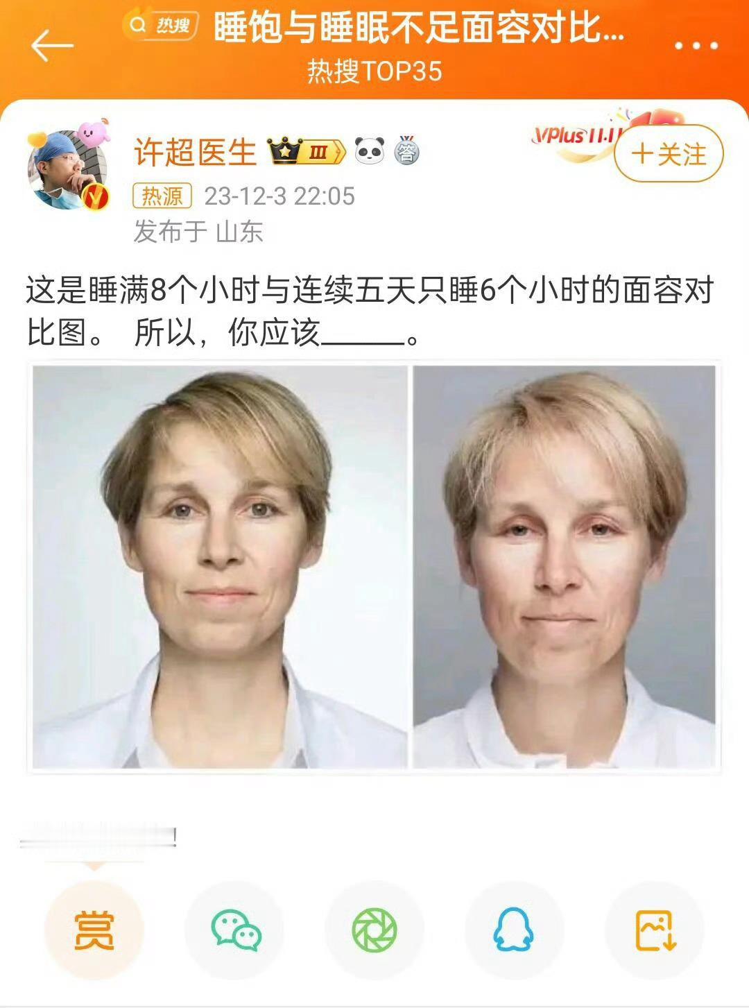 每天只睡6小时身体的变化所以，我应该—— 