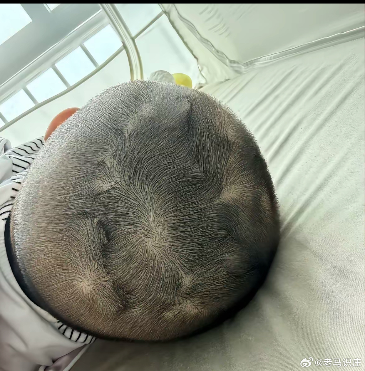 这么多头旋，你见过吗？ 