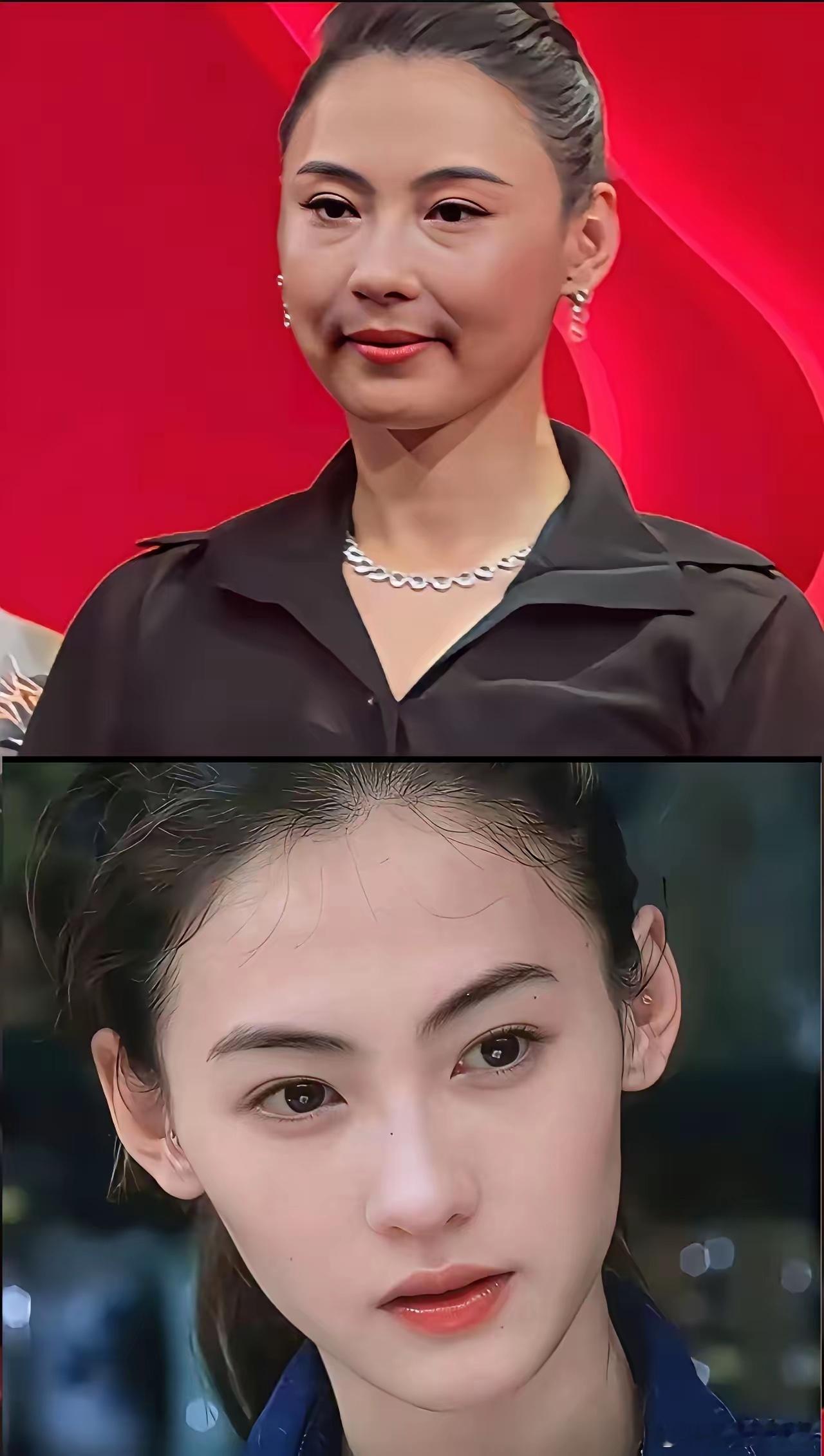 这是明显玻尿酸打多了吧，女神有需要用玻尿酸吗 ​​​