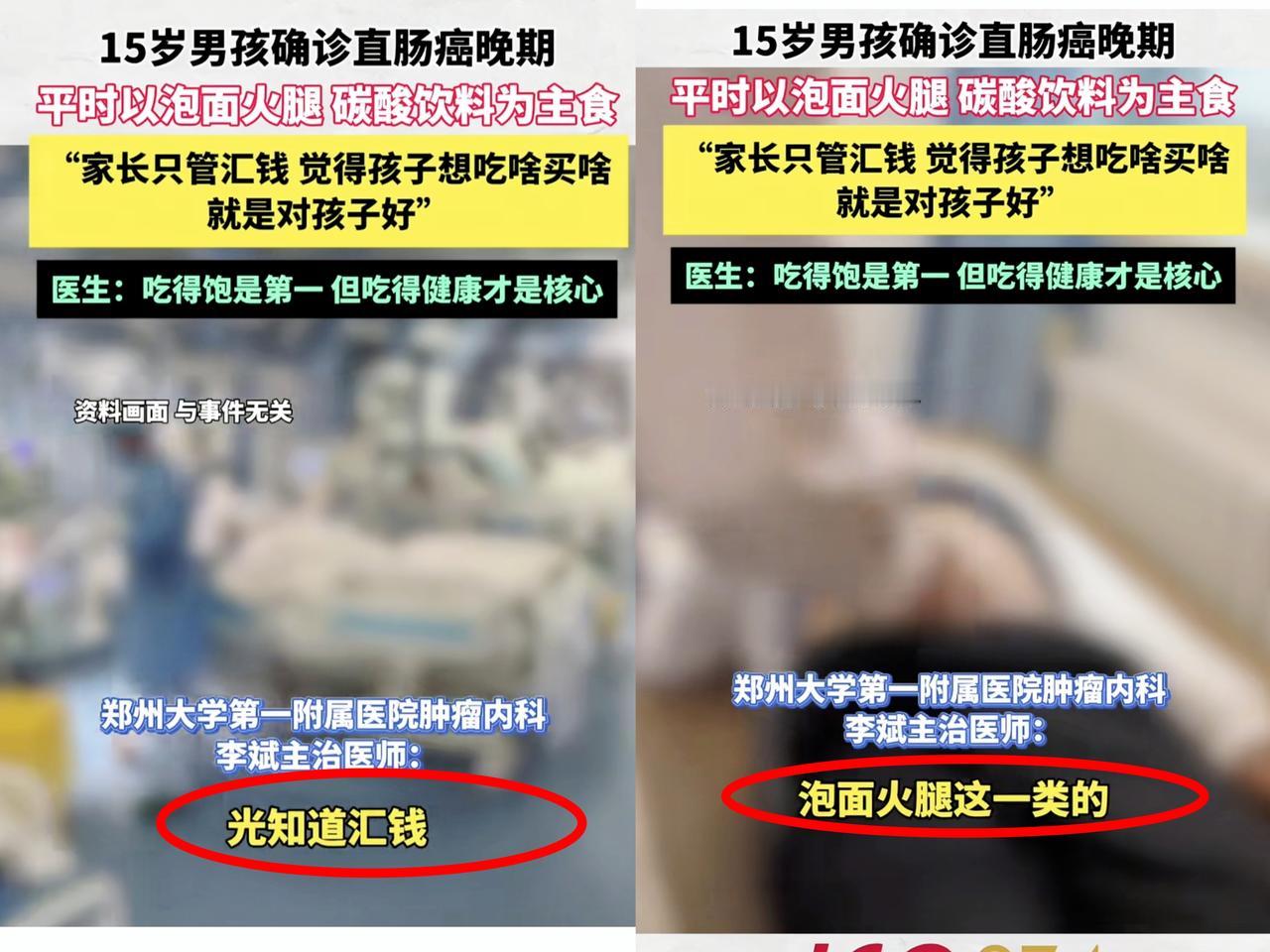 刷到15岁河南男孩，
经常吃泡面火腿肠碳酸饮料
竟得了直肠癌晚期，
我心都揪得慌