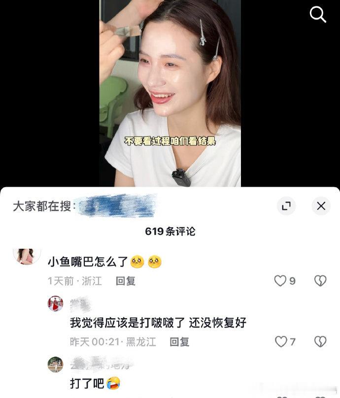 小鱼海棠疑似打了嘟嘟唇 小鱼海棠最新出镜嘴唇明显变丰盈，网友都在追问是不是打了嘟