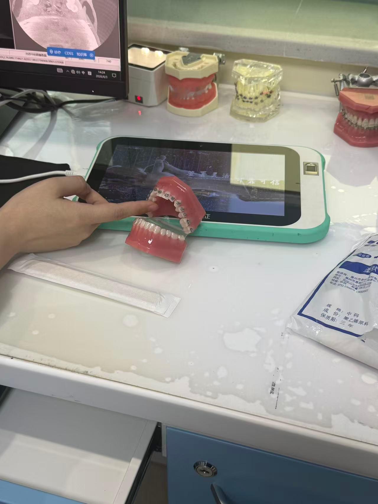 牙齿矫正是选钢牙套好还是隐形牙套好