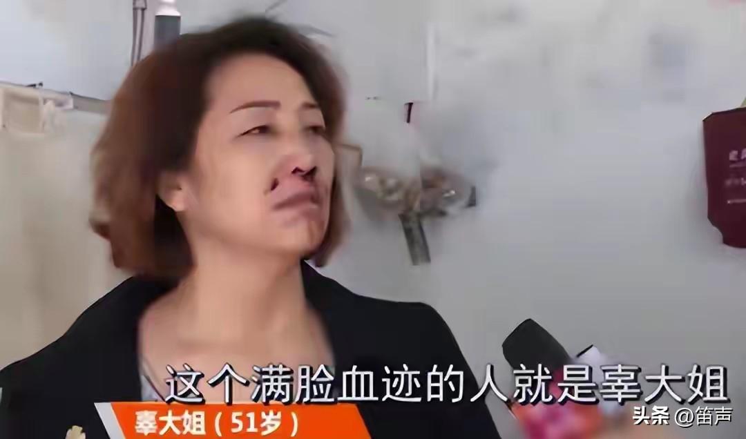 51岁的辜大姐，从菜市场买菜回来，因为抱孙子前没有洗手，被儿子一拳打断了鼻梁，看