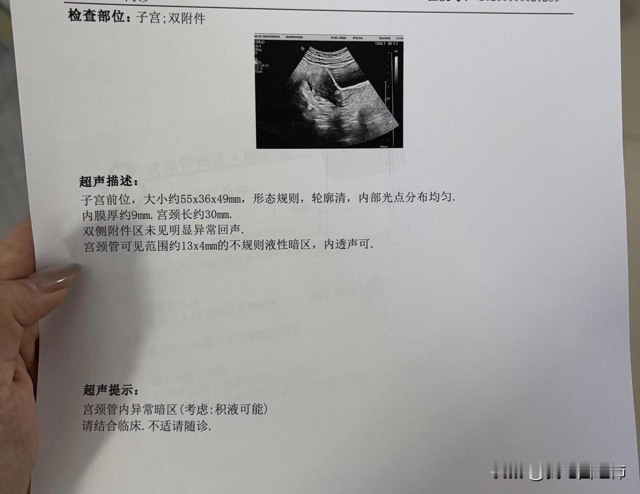 求助大家，19岁，没有性生活，已经70天没有来月经了，做了B超和性激素六项，医生