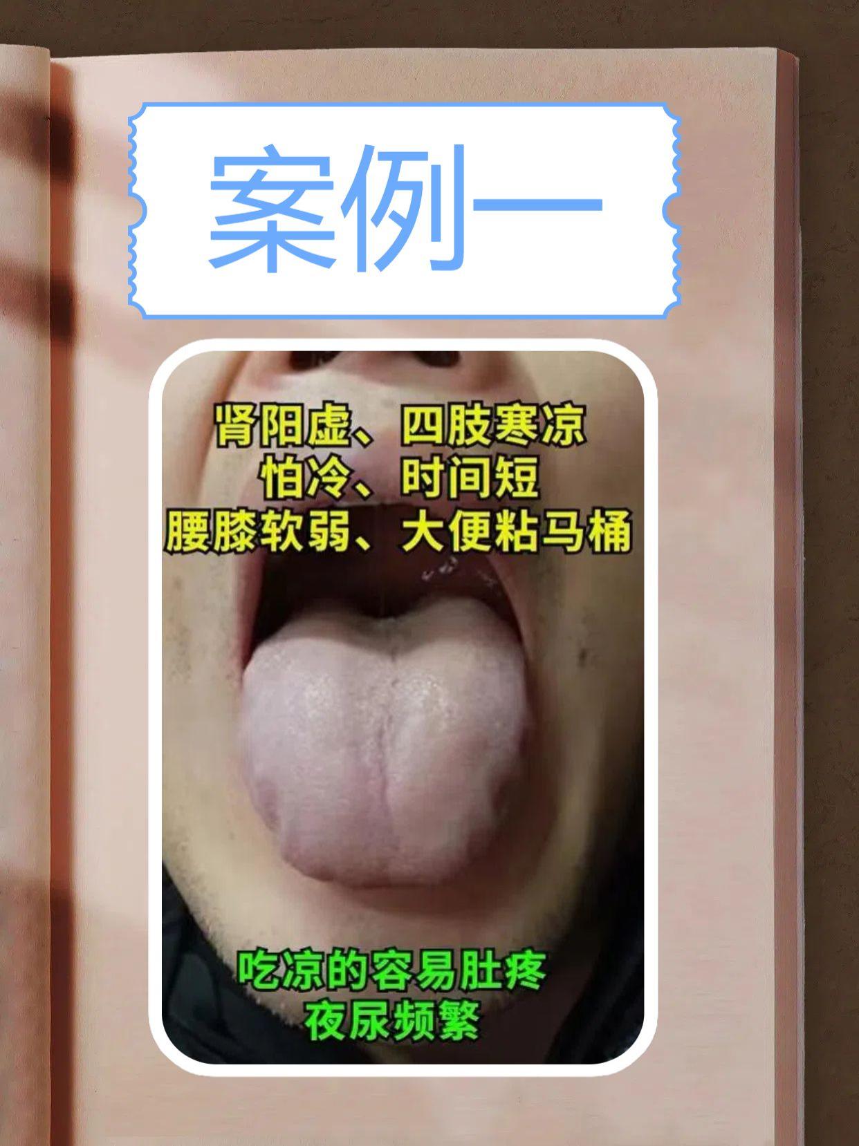 免费舌诊：今天周日，挑战一下自己，看完200个舌象！

前几天粉丝一直私信我说，