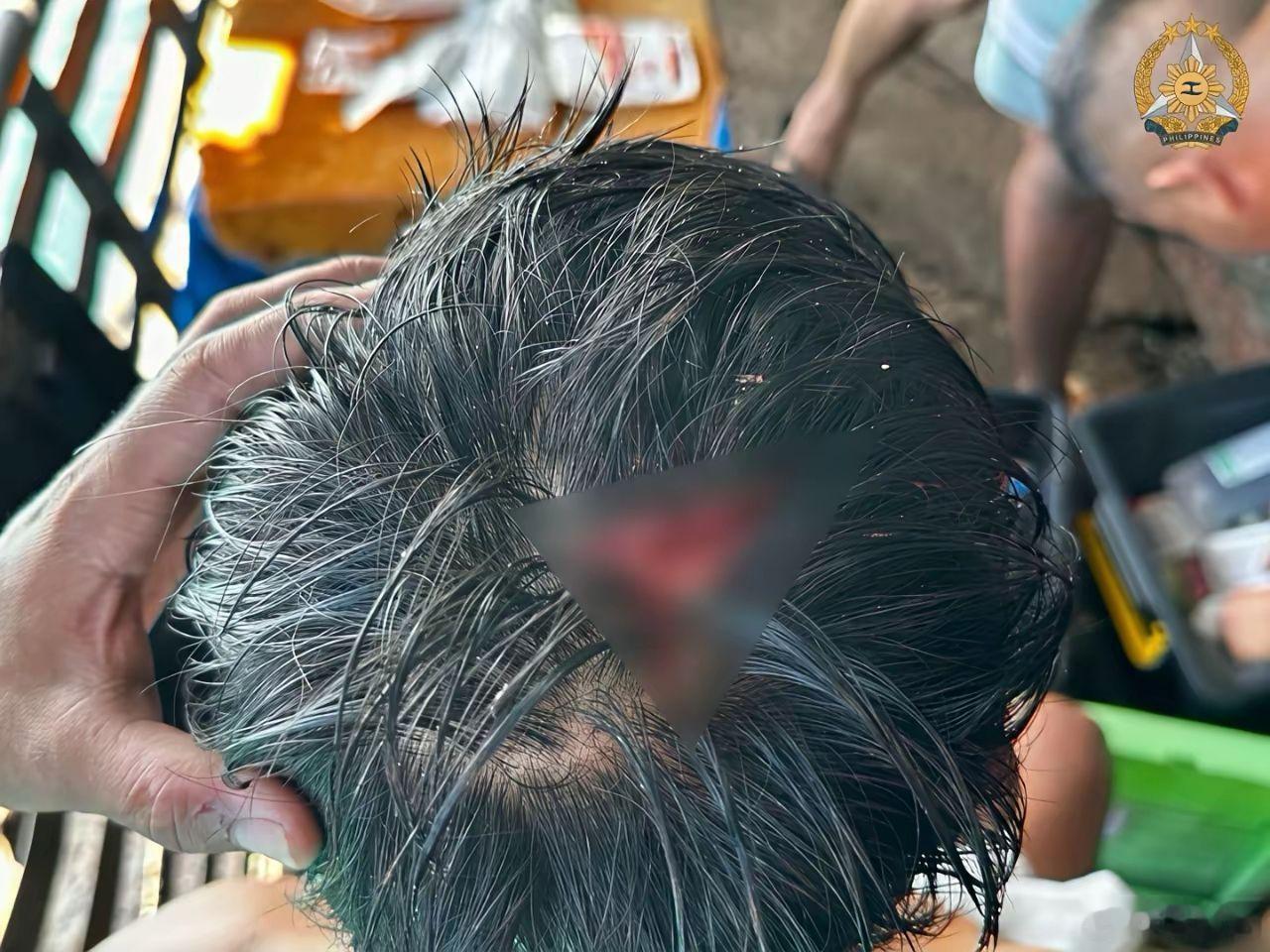菲猴竟敢主动出击，这波气焰不给它按下去，以后无法无天了，我不关心菲猴伤的怎么样，