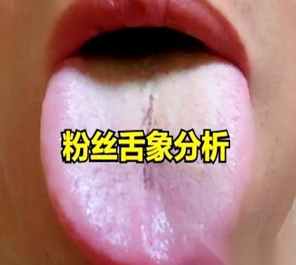 一个男人，笃定自己是肾虚，猛补了小十年。
结果呢？老婆的叹气声越来越响，他自己更