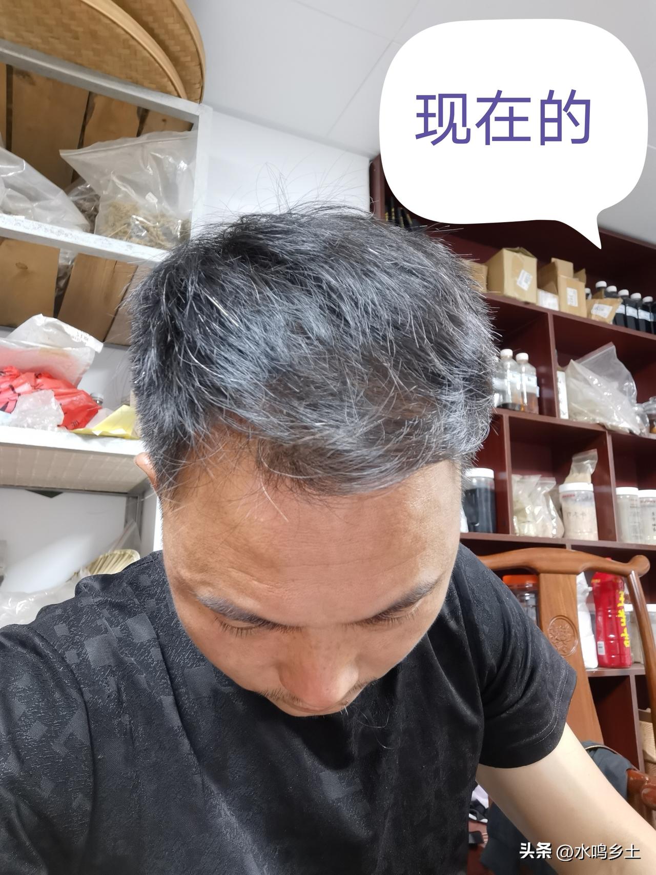 有人问我头发重新长出来了吗？说实话，头发重新长出来确实有点难了，只是相对于现在掉