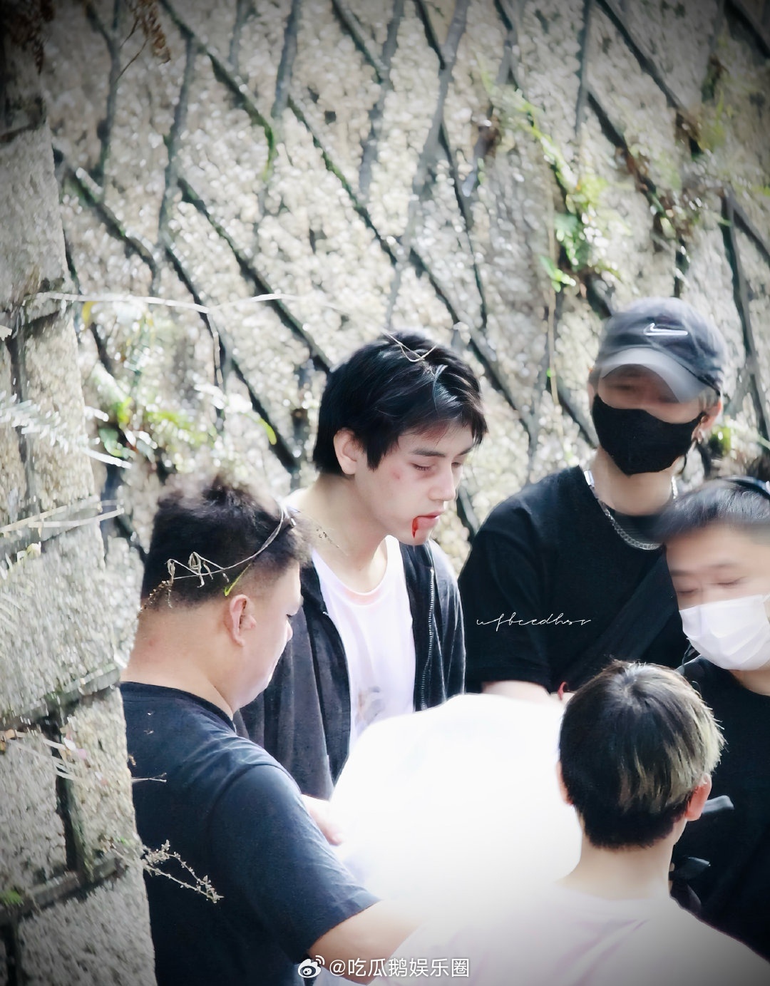 以为陈飞宇挨打了以为陈飞宇被打了 战损妆质感直接拉满，化妆师的手艺真的太专业了 