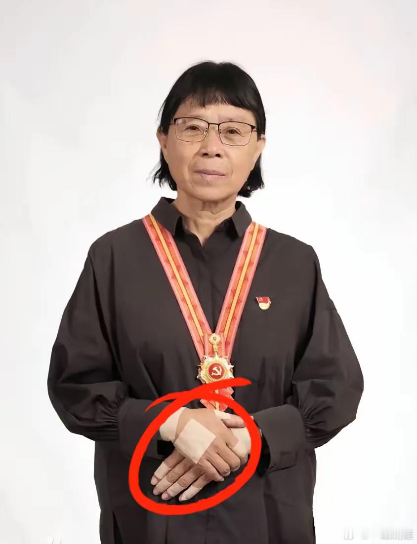 张桂梅，快七十的女校长，时常咳嗽，身体不太好，手也会肿得缠满膏药……​可她依然是