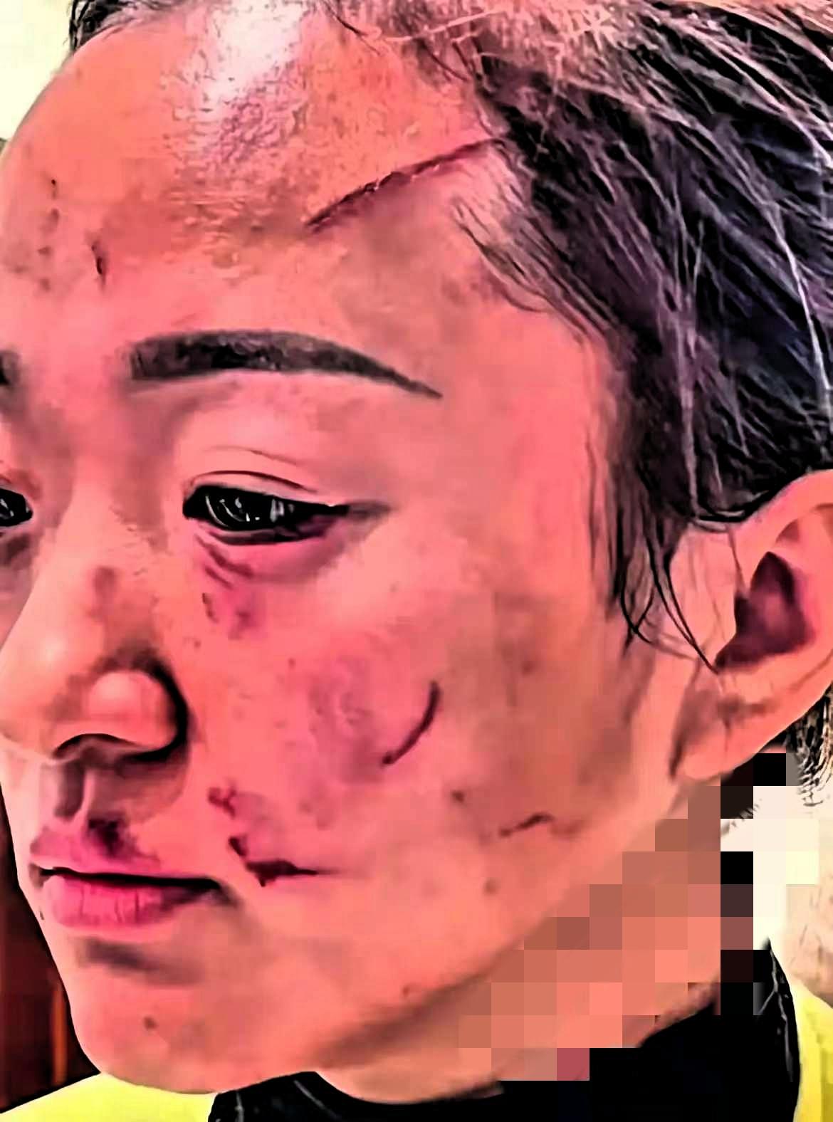 婆媳动手赔5万断来往，这哪是家务事，分明是戳破了相处真相！

没有血缘的婆媳，本