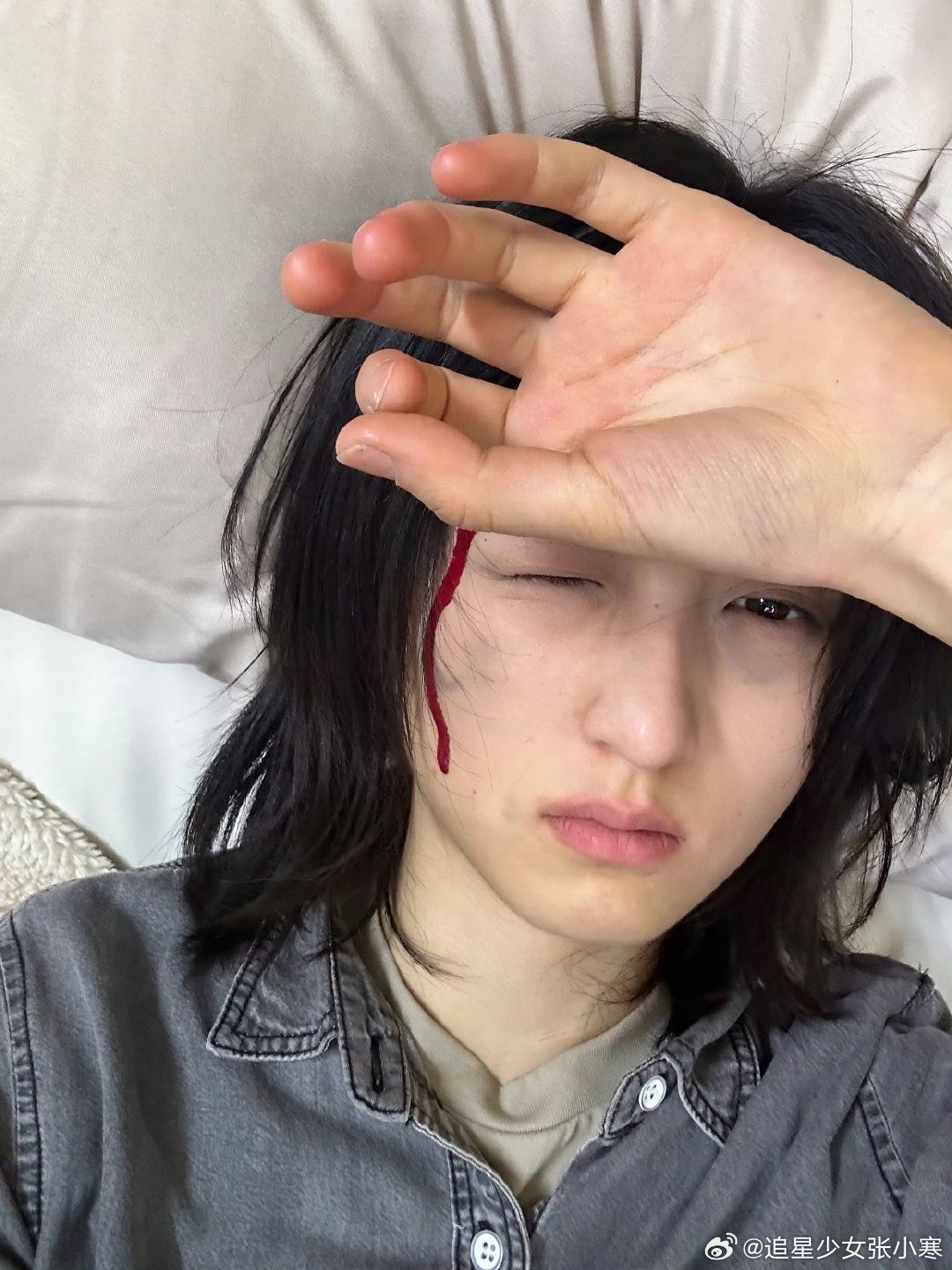 张子枫战损妆live图 张子枫伤痕妆那逼真伤痕真让人心疼，不过何秋果的角色魅力摆
