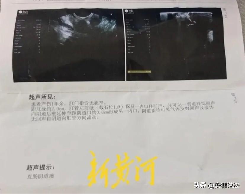 “扎心！”河北任丘，29岁女子在医院顺产生孩期间，医生给其做了个侧切手术，结果因