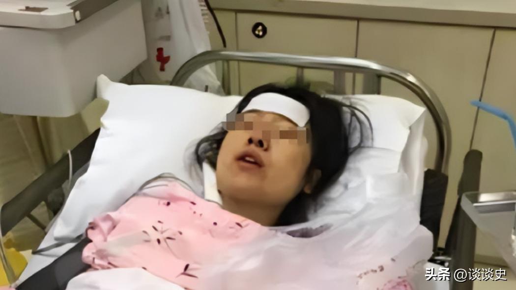 2018年，21岁女大学生不慎被毒蛇咬伤，送往医院抢救时，情况相当不乐观，趁女子