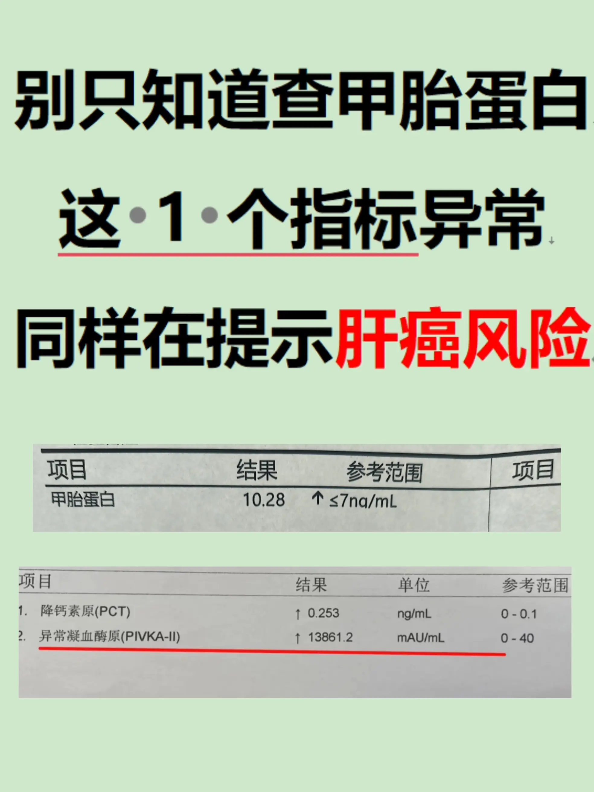 大家好，我是肝病科医生阚晓。从医十几年，发现很多肝硬化、慢肝患者，查肝...