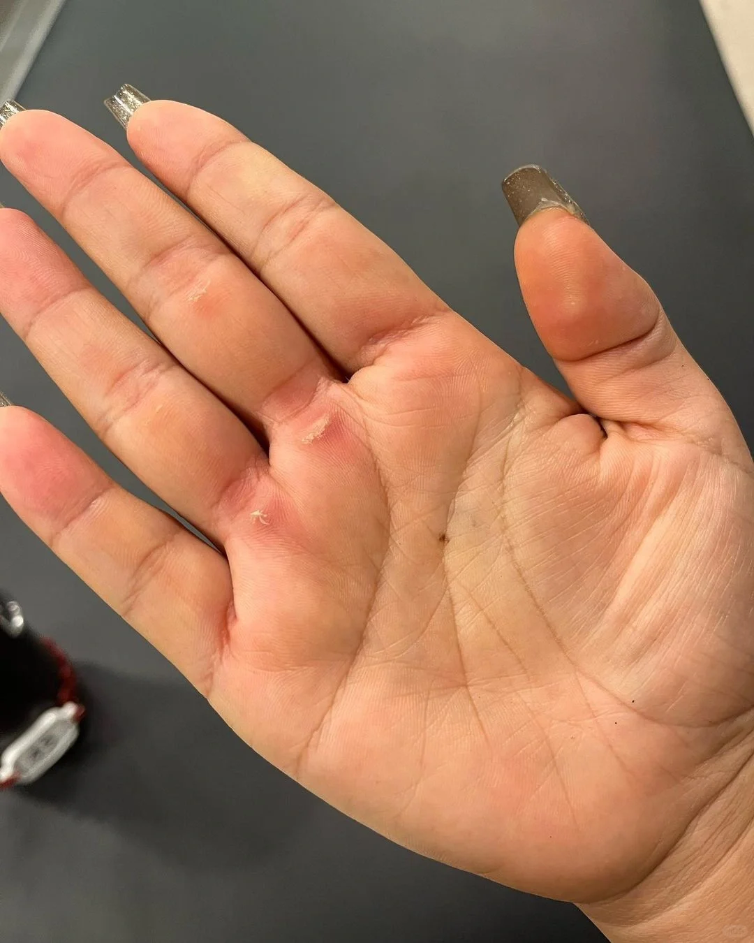 撸铁撸得一手老茧，还有人说没训练痕迹👿