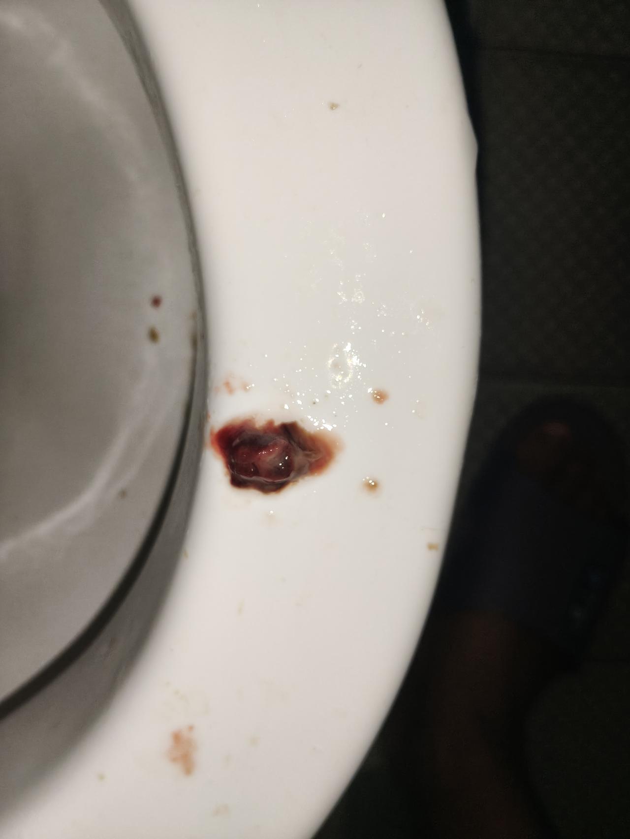 鼻窦炎、鼻中隔偏曲、鼻息肉手术后都快半个月了，每天冲洗鼻子仍然会冲出不少血块来，