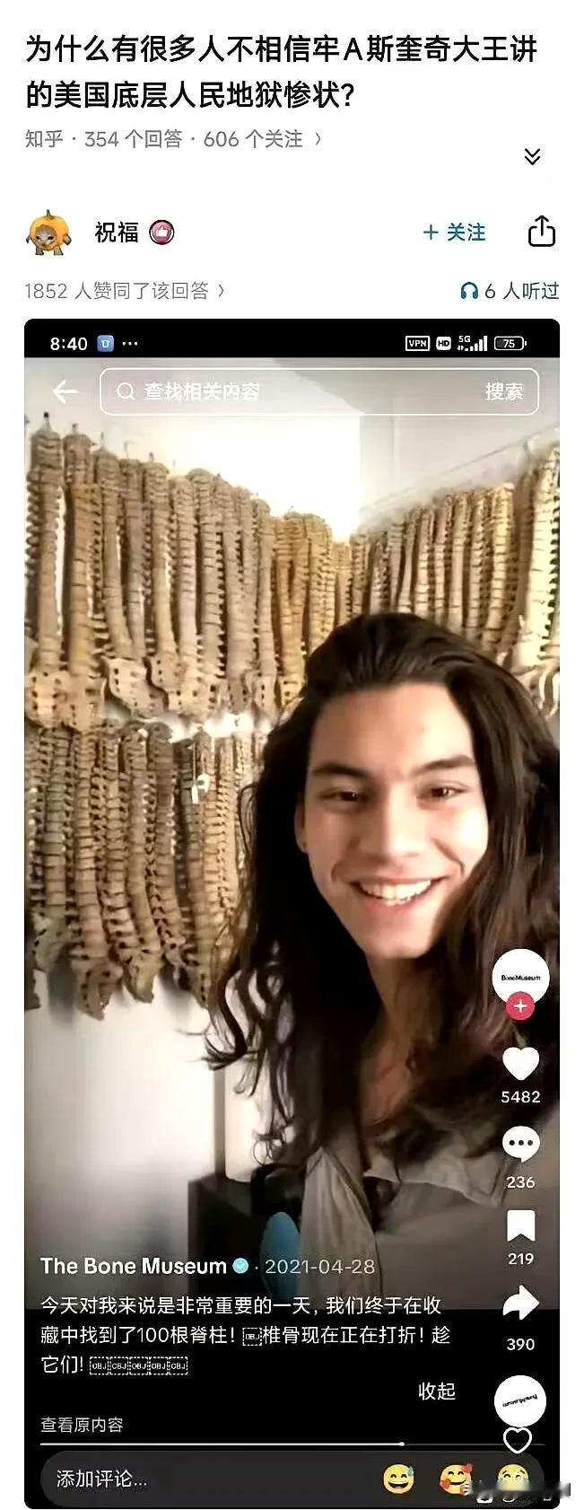 美国底层人真的跟炼狱一样，有个美国博主炫耀自己的收藏，凑够了100根人的脊椎骨，