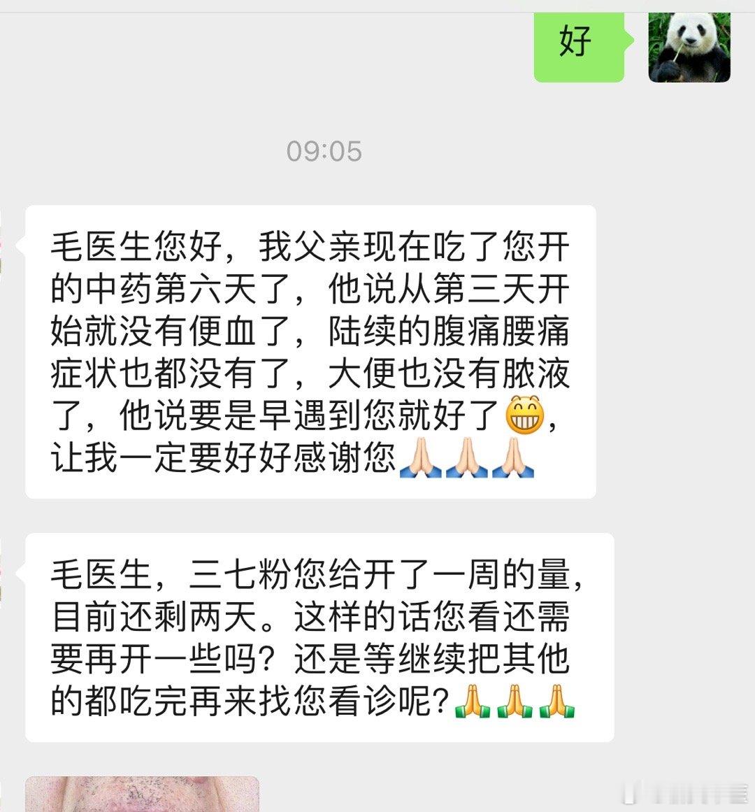 【从第三天开始就没有便血了！】溃结，反馈。上周看的溃结病人，中度，活动期。刚才收