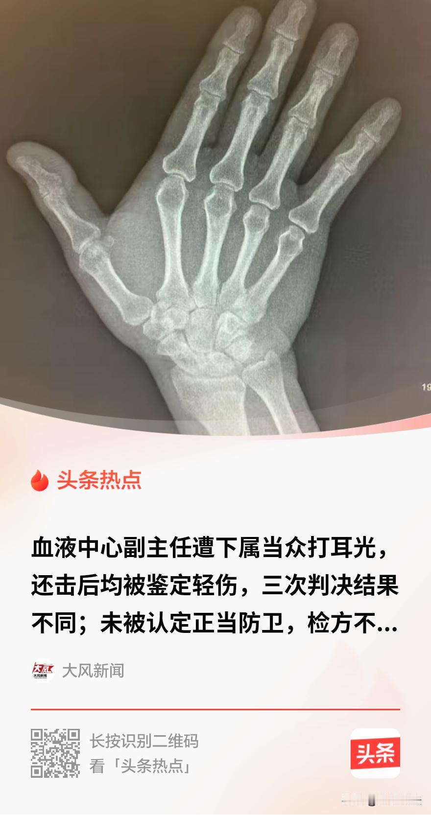 “冤不冤？”内蒙古，一男子曾是血液中心副主任，因工作安排，与宣传科长发生争执。男