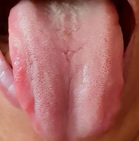 附子理中丸，这一中药方剂，自古以来便在中医界享有盛誉，被誉为调理脾胃的“神药”。