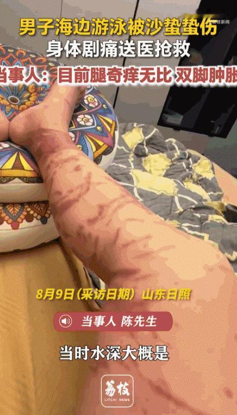 山东日照突发惊险一幕！男子在海边浅水区游泳，突遇水下隐形致命威胁，瞬间触电般剧痛