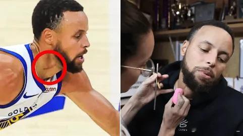 今日，勇士球员接受媒体采访，在谈到自己身上的疤痕时说：“我想等我退役之后，不管是