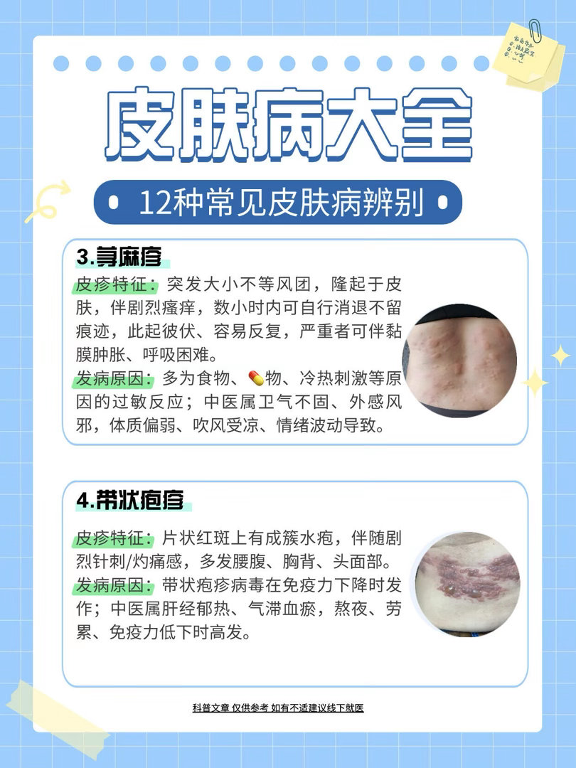 皮肤病的轻重从来和外观无关AI看皮肤病准确率到底有多高我觉得Ai可以当做辅助工具