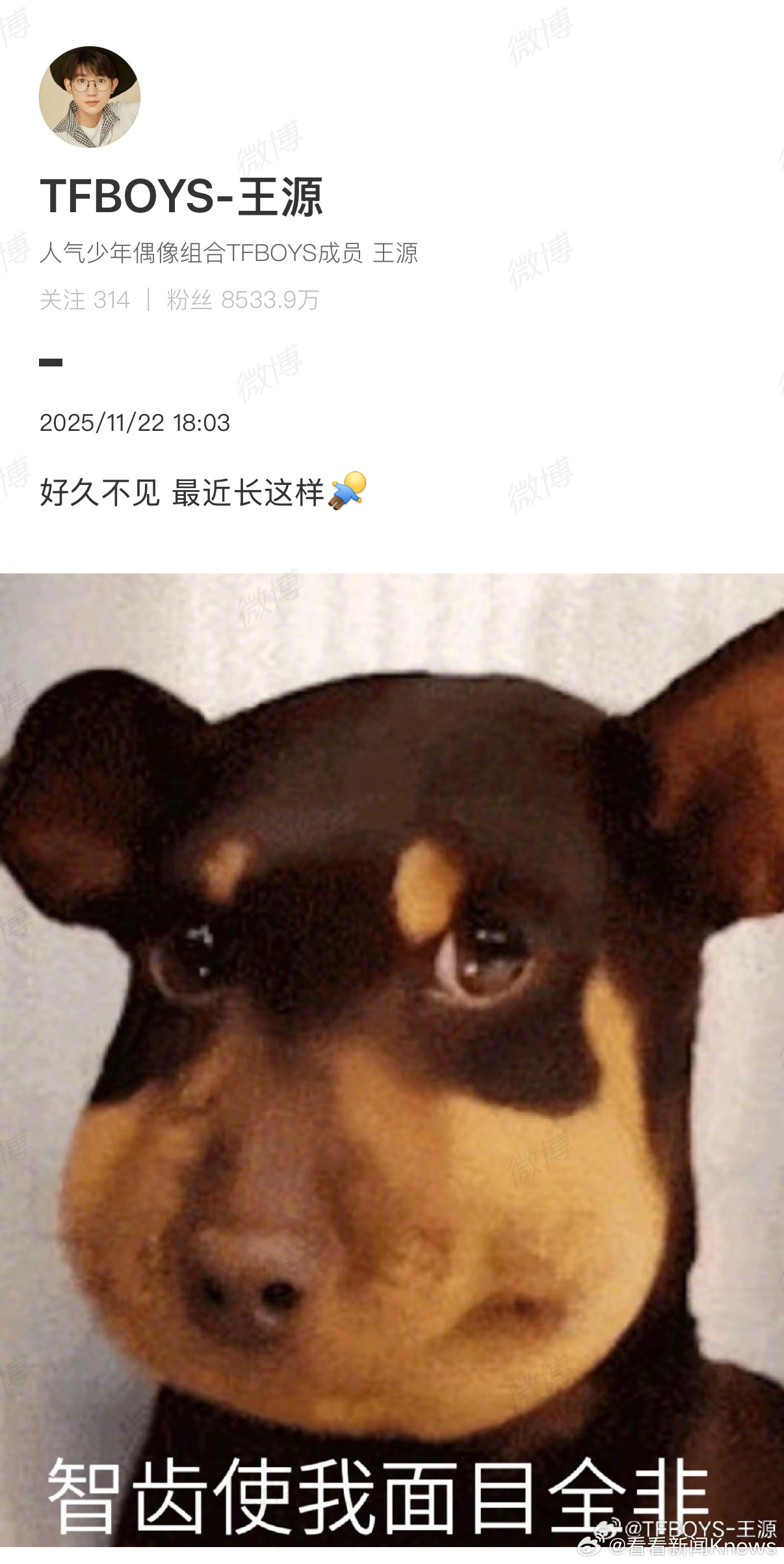 11月22日， 发文：“好久不见 最近长这样  ”并配了一张“智齿使我面目全非”