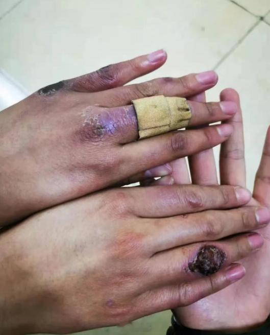 这是一双边防女兵的手，心疼❤️致敬中国军人！ ​​​