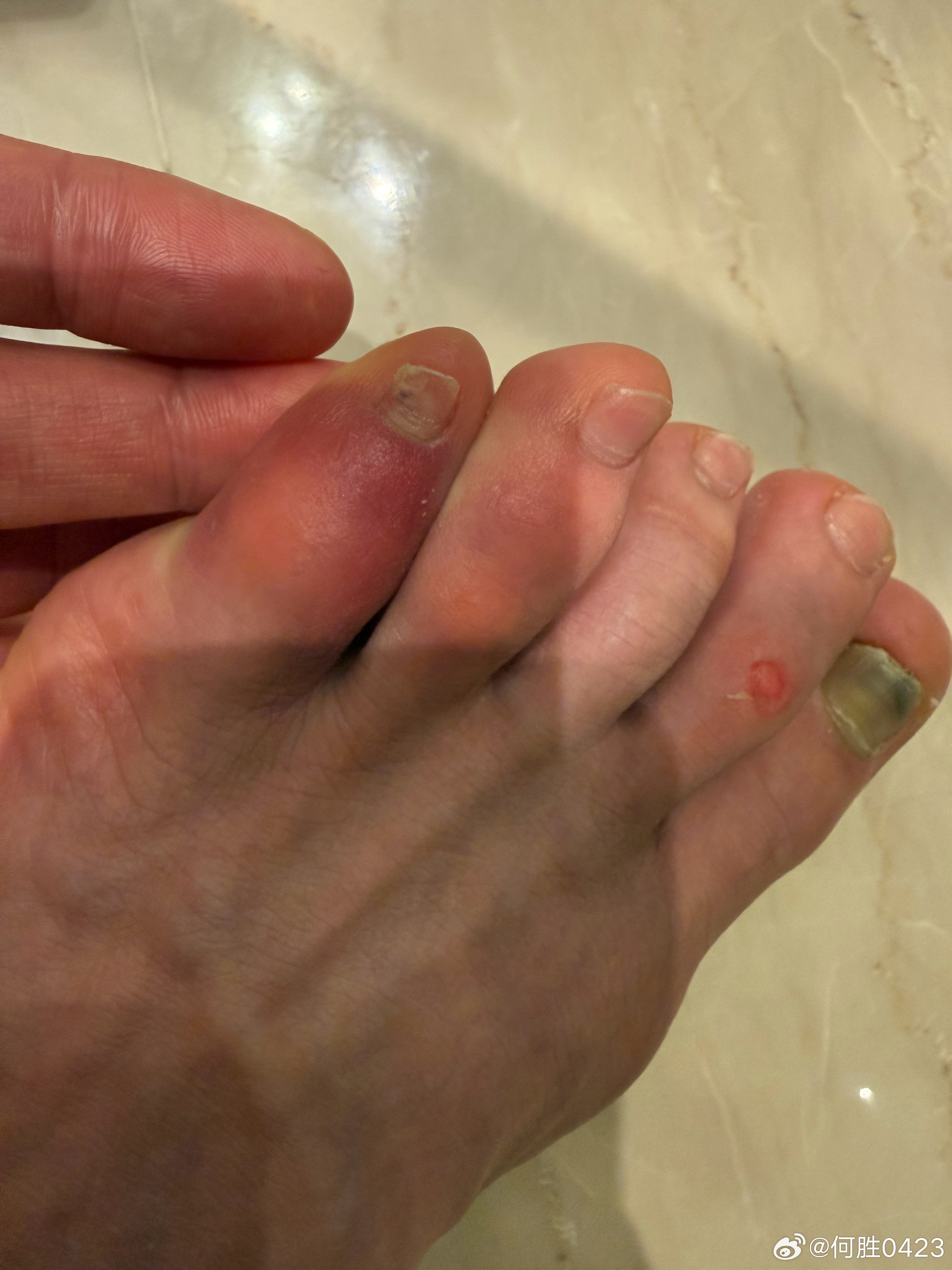 废了，两天踢了三场 