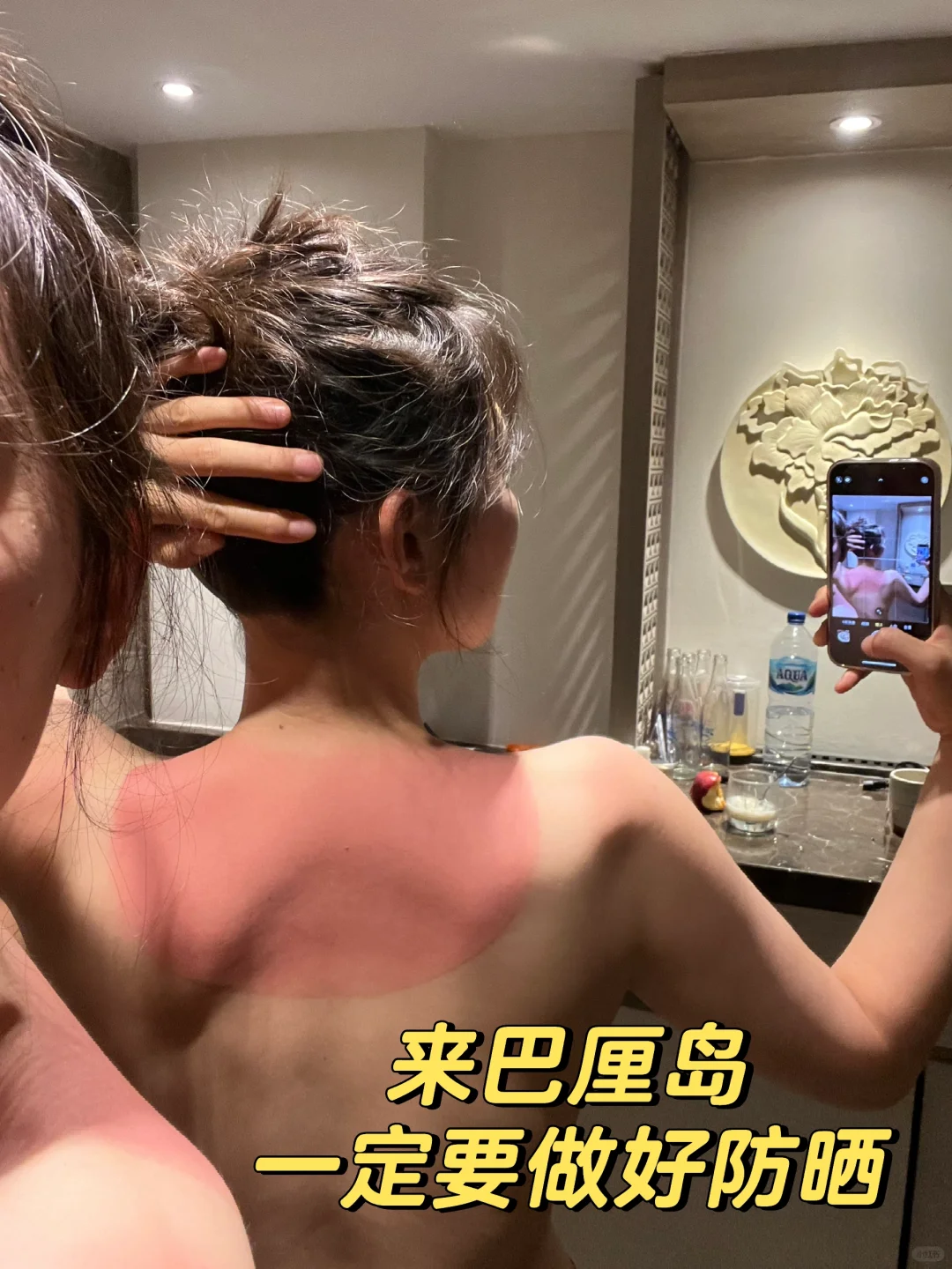 一不小心就晒伤了