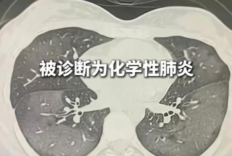 近期有一则新闻，河南一个5岁的小孩，家长给他喷防晒喷雾时，孩子突然出现呼吸困难。