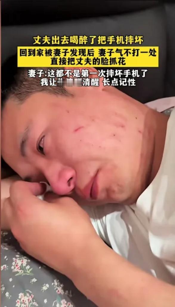 摔手机被抓花脸！
这对夫妻的闹剧，
戳中多少婚姻的死穴
 
丈夫醉酒摔手机，
妻