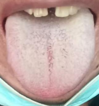 阳气亏虚宗筋难起，一补一通重振雄风






有不少朋友都会面临这样的困扰，虽