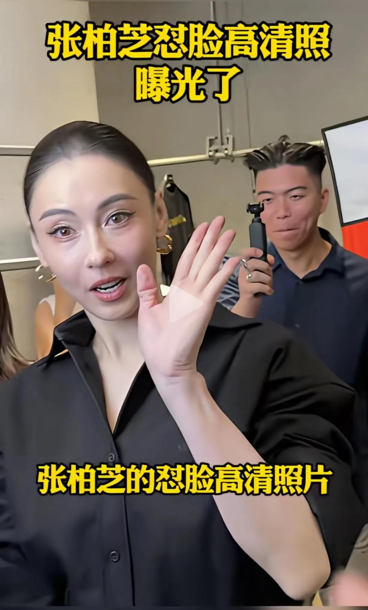 张柏芝越长越像老外，脸蛋看着没有以前那么自然精致，看着很不自然。