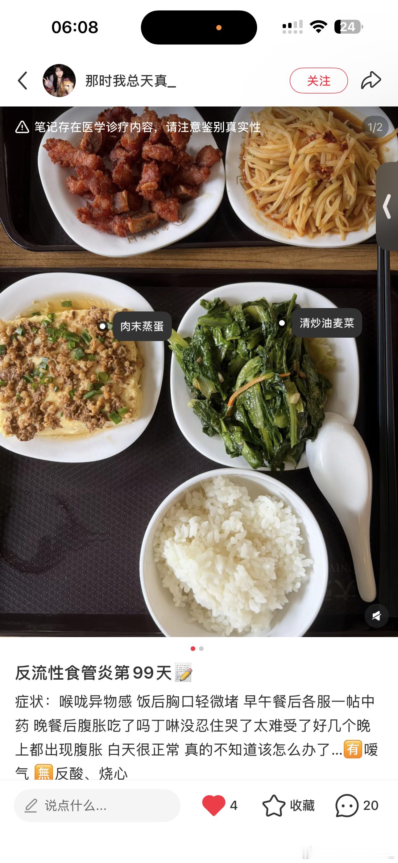 胃食管反流真的不是人得的病已经超级注意饮食了各种药全吃了还是很难受现在刷到xhs