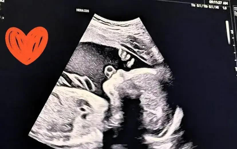 宋承炫官宣妻子怀孕即将升级当爸，偶像蜕变丈夫再启父亲新篇 