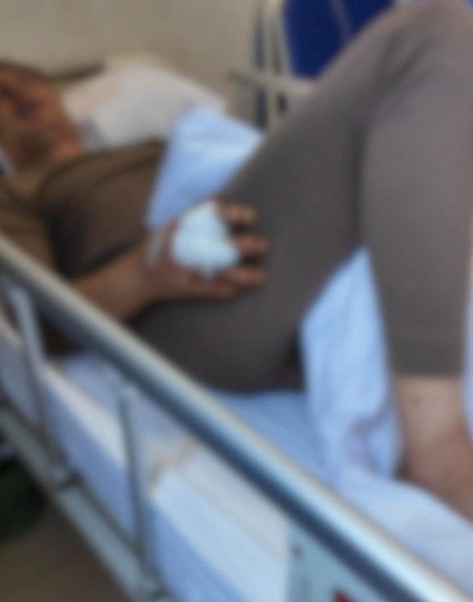 【遭熊袭击男子称雨靴救了自己一命】男子讲述遭黑熊袭击死里逃生经过9月22日，重庆