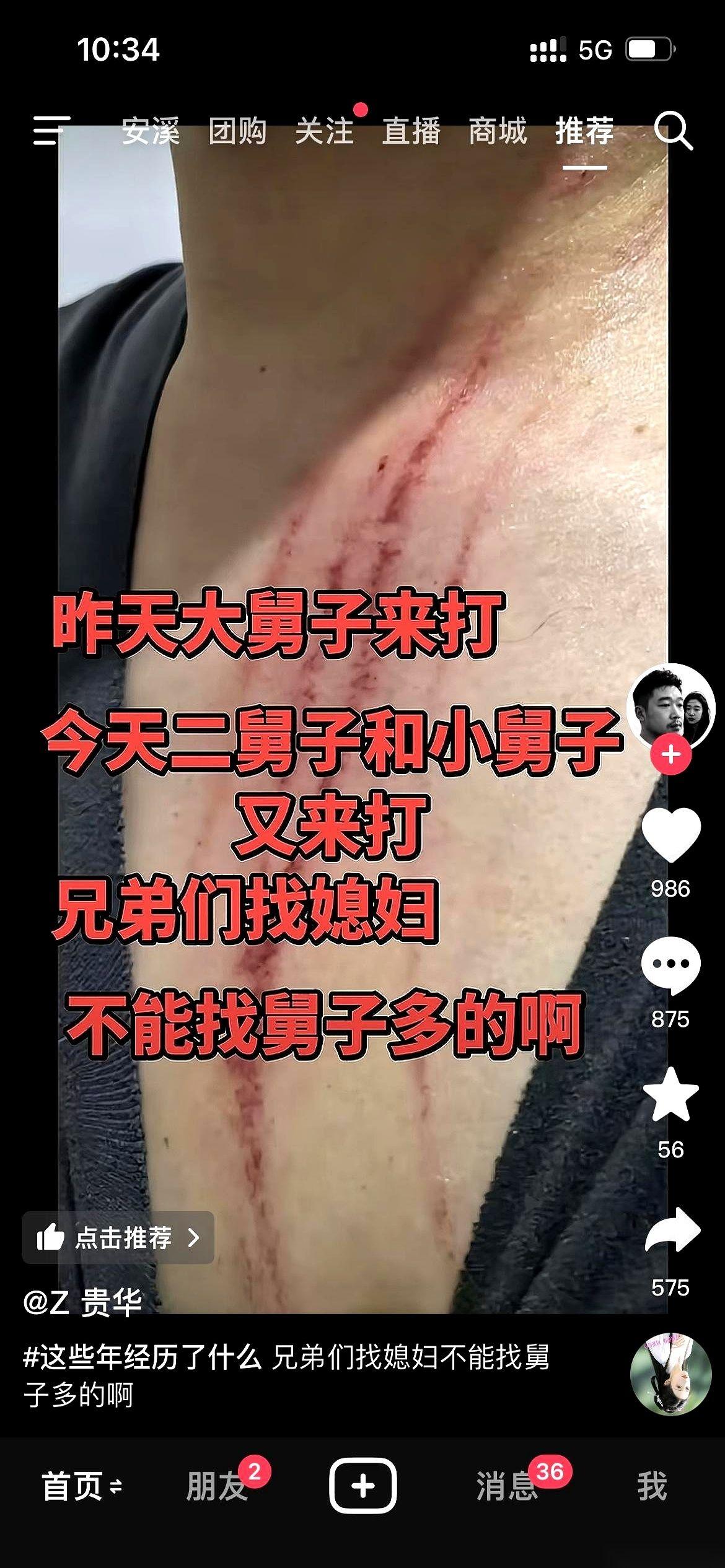 又跟媳妇吵起来了，就为点鸡毛蒜皮的小事。
她眼睛一瞪，筷子往桌上重重一放，声音拔